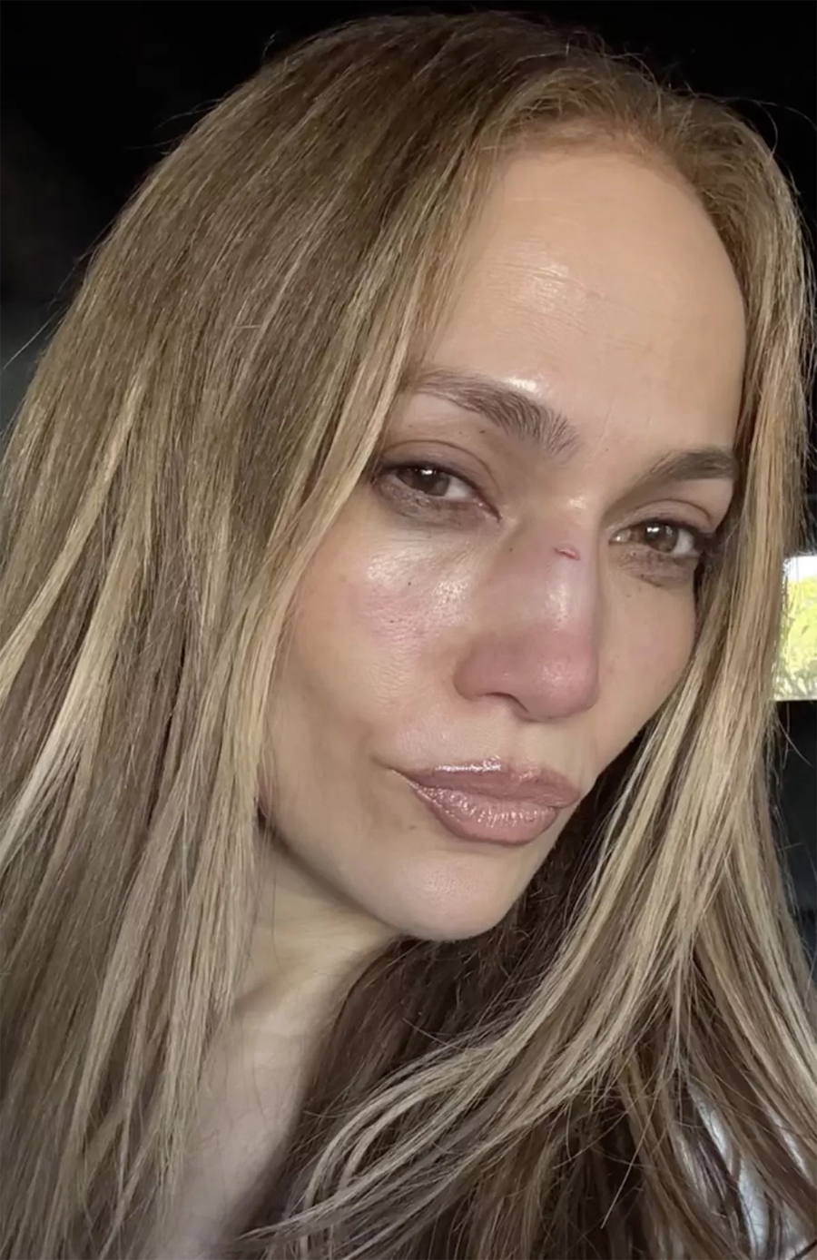 Jennifer Lopez sustains facial wound during American Music Awards rehearsals